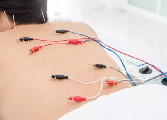 electricacu